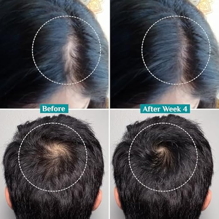 Pilgrim Redensyl 3% + Anagain 4% Advanced Hair Growth Serum (50ml) with Natural Ingredients, Controls Hair Fall, Stimulates Hair Growth, Increase Hair Density | Hair Growth Serum for Men & Women - Image 5